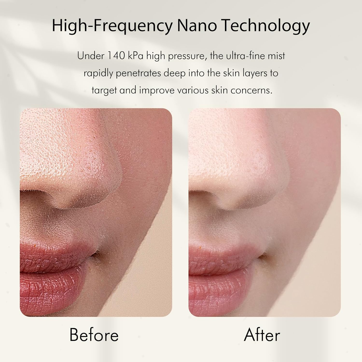 เครื่องพ่นไอน้ำนาโนไอออนิกแบบพ - Facial Steamer Nano บทวิจารณ์และราคา